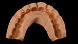 Fig. 8a. Mock-up de silicona.