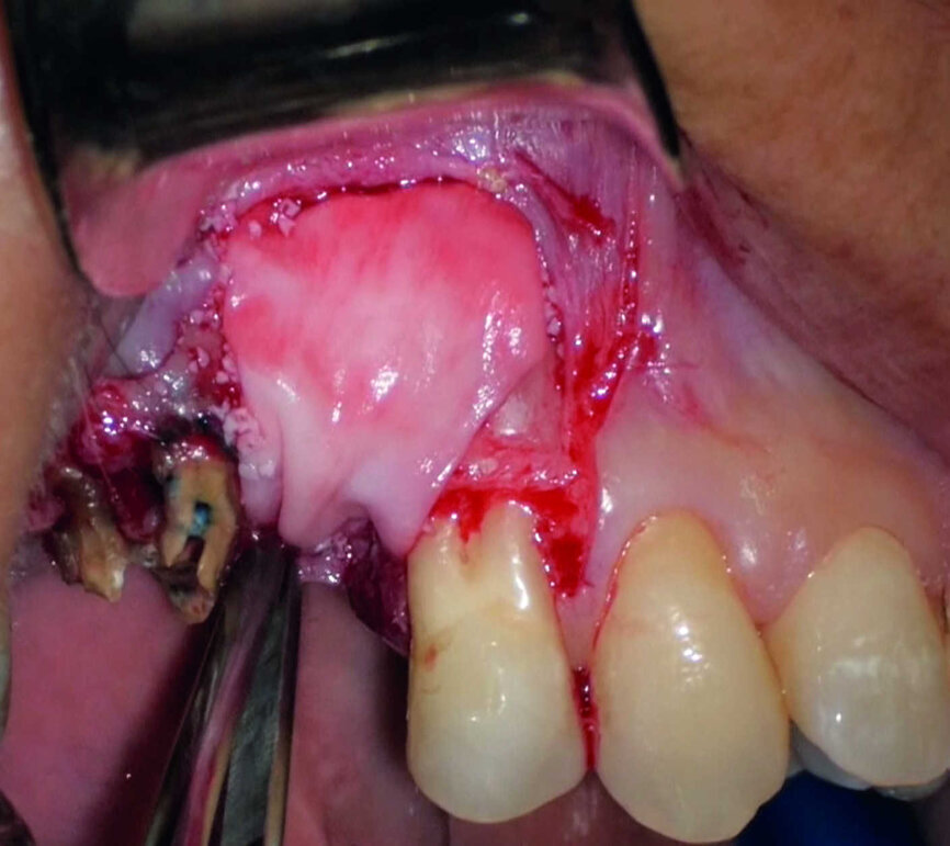 Figure 28