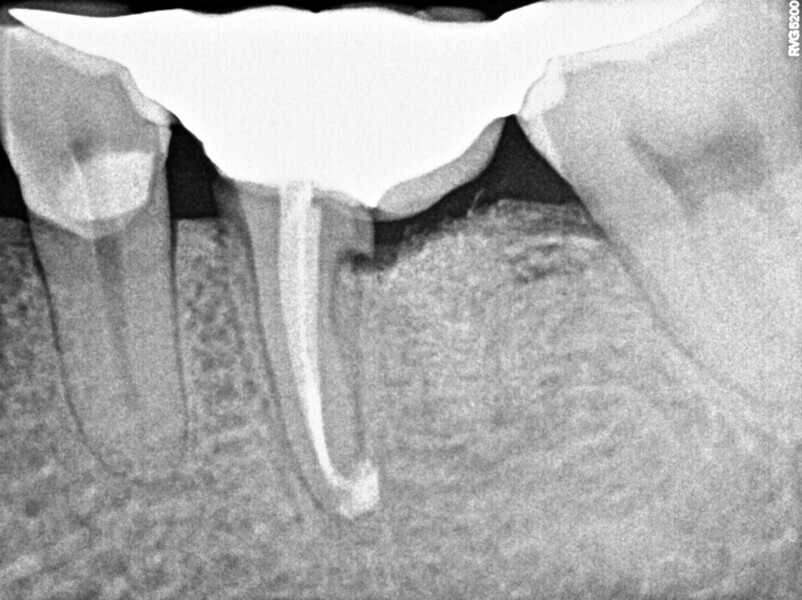 Fig. 11