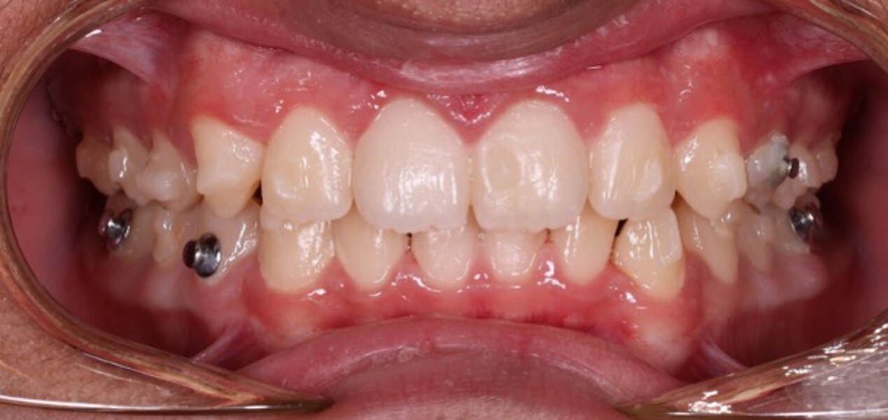Fig. 6d