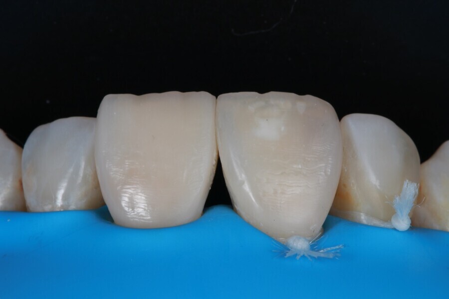 Fig. 5i
