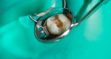 Successful endodontics—how to effectively use modern endodontic solutions in everyday practice
