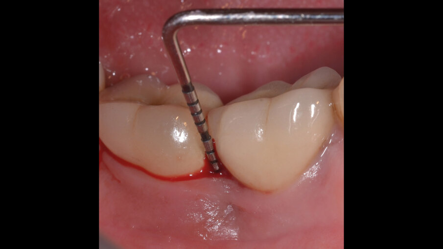 Fig. 1a