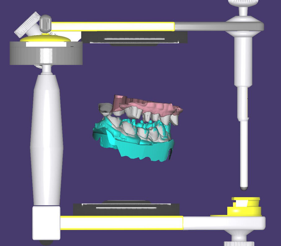 Fig. 25
