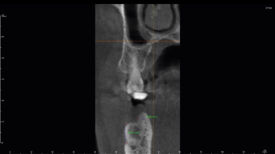 Fig. 16