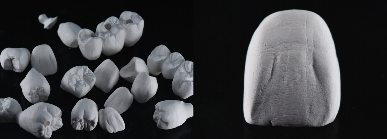 Figs. 6a & b: Beautiful surface results after manual surface treatment.