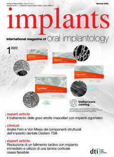 implants Italy No.1, 2022