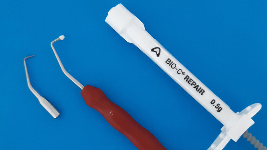 Case report: The use of Bio-C Sealer and Bio-C Repair in periapical surgery