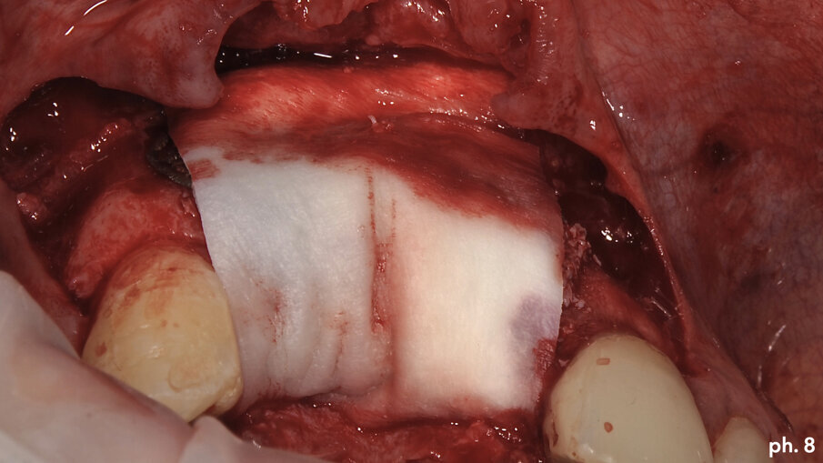 Fig. 8