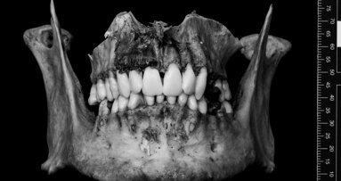 New digital 3D models for forensic odontology education