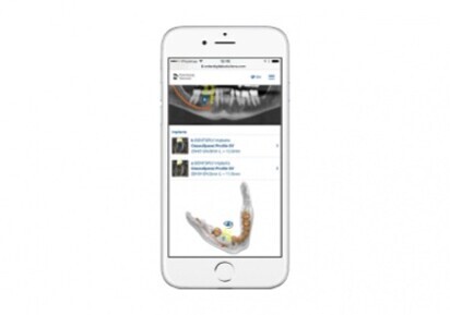 Dentsply Sirona – mySimplant Planning Service