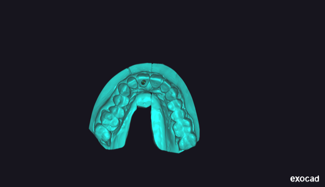 Fig. 18
