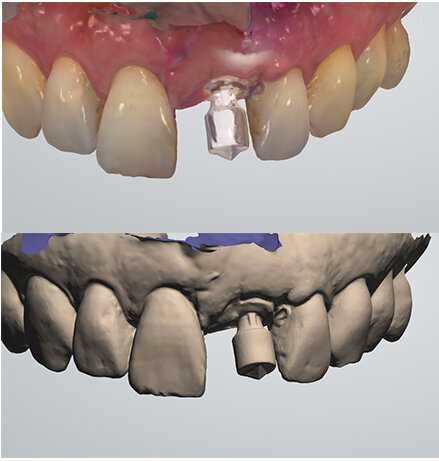 Fig. 24
