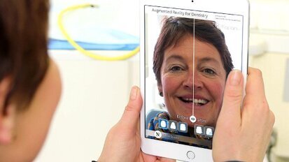 Ivoclar Vivadent acquisisce Kapanu, una start-up svizzera