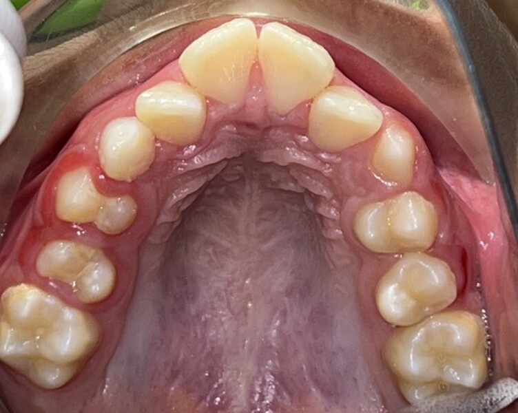 Fig. 2b