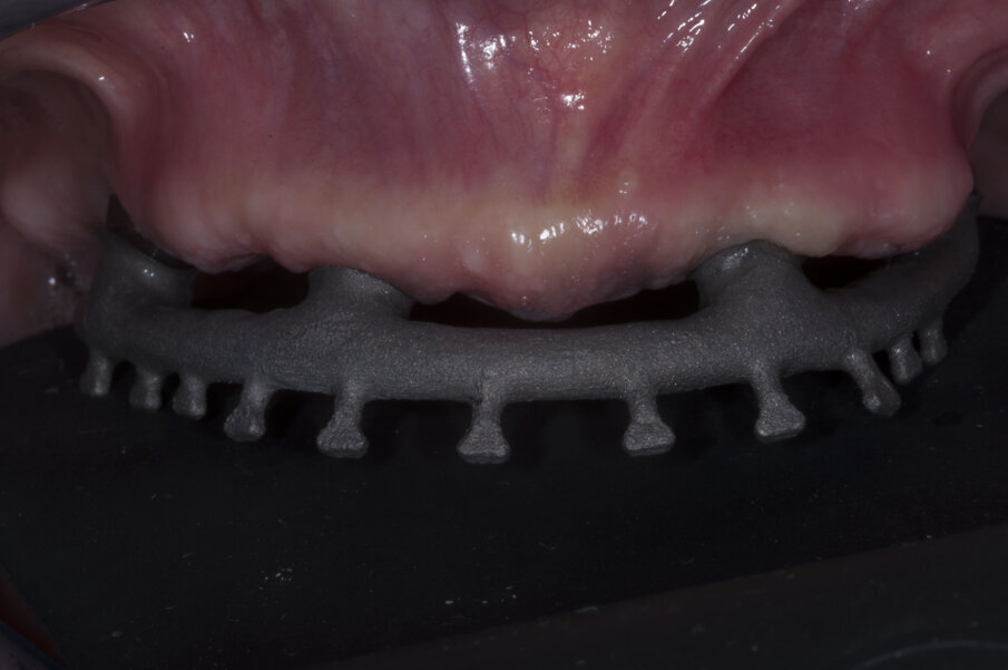 Fig. 35