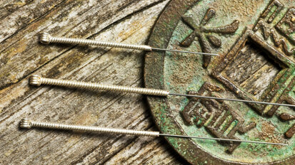 Acupuncture: Probing its way into dentistry—Part II