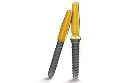 Intermezzo Implant