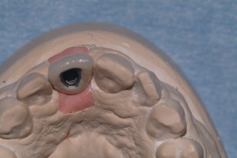 Fig. 18