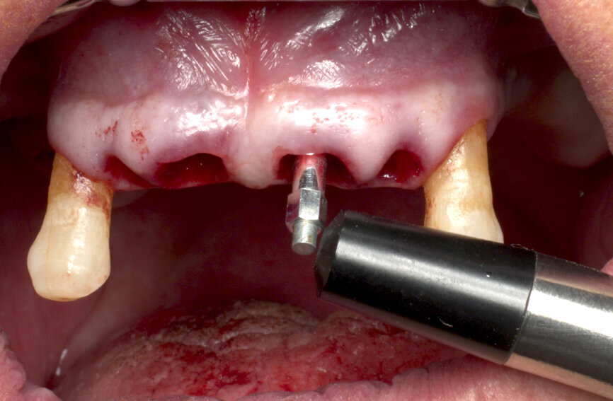 Fig. 7