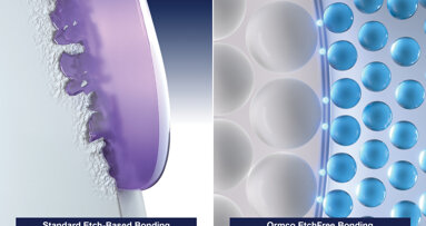 Ormco EtchFree Bonding system: Introducing the next generation of bonding, inspired by nature