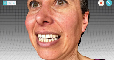 3D face scanning: Affordable and user-friendly