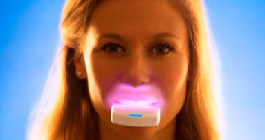 La PBM, terapia intra-orale di fotobiomodulazione potrebbe ridurre il tempo di trattamento ortodontico