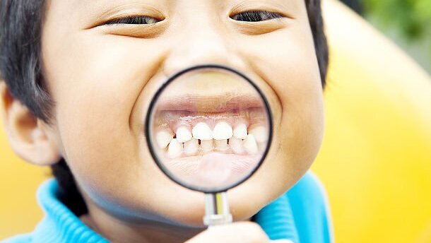 Cerca de um sexto das crianças em Xangai sofrem de erosão dentária