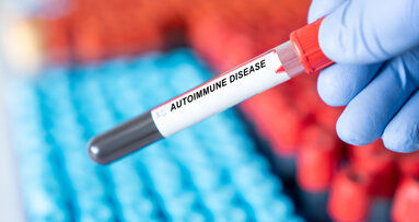 Study links periodontal disease to autoimmune disease and all-cause mortality