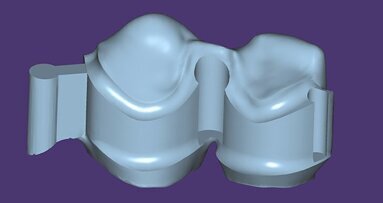 exocad DentalCAD: la nuova generazione