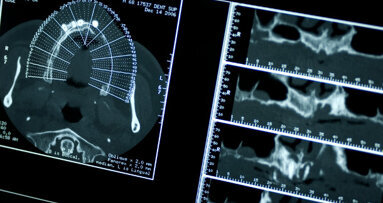 Patientenumfrage: Höhere Beiträge für moderne Medizintechnik akzeptabel