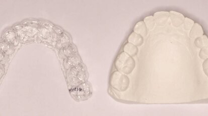 El protocolo clínico del CA Clear-Aligner