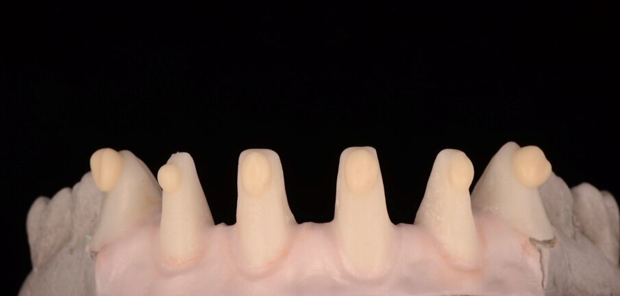 Fig. 25: Highly uid GC Initial LiSi ceramic is applied to the zirconia framework.
