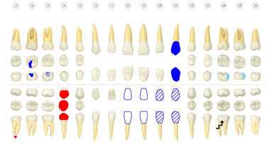 Henry Schein unveils beta version of cloud-based Dentrix Ascend practice management system