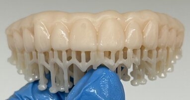 The use of inexpensive 3D printers to provide in-office solutions for immediate temporary restorations on implants
