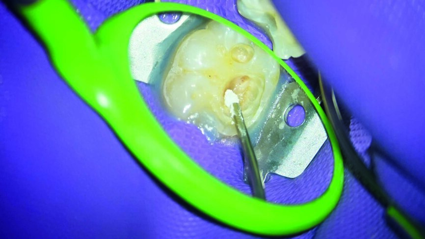 Fig. 4