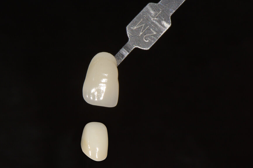Fig. 3. Coincidencia perfecta entre la guía Toothguide 3D-MASTER de VITA y el color de la cofia.