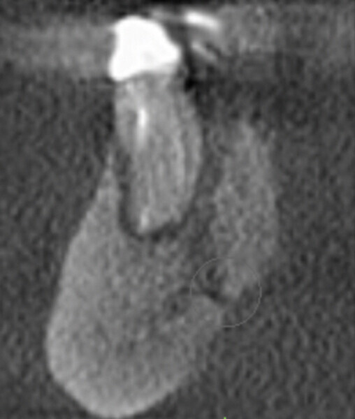 Fig. 11c