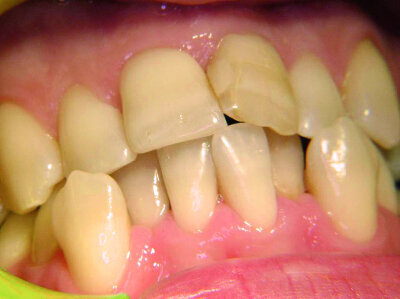 Figure 18