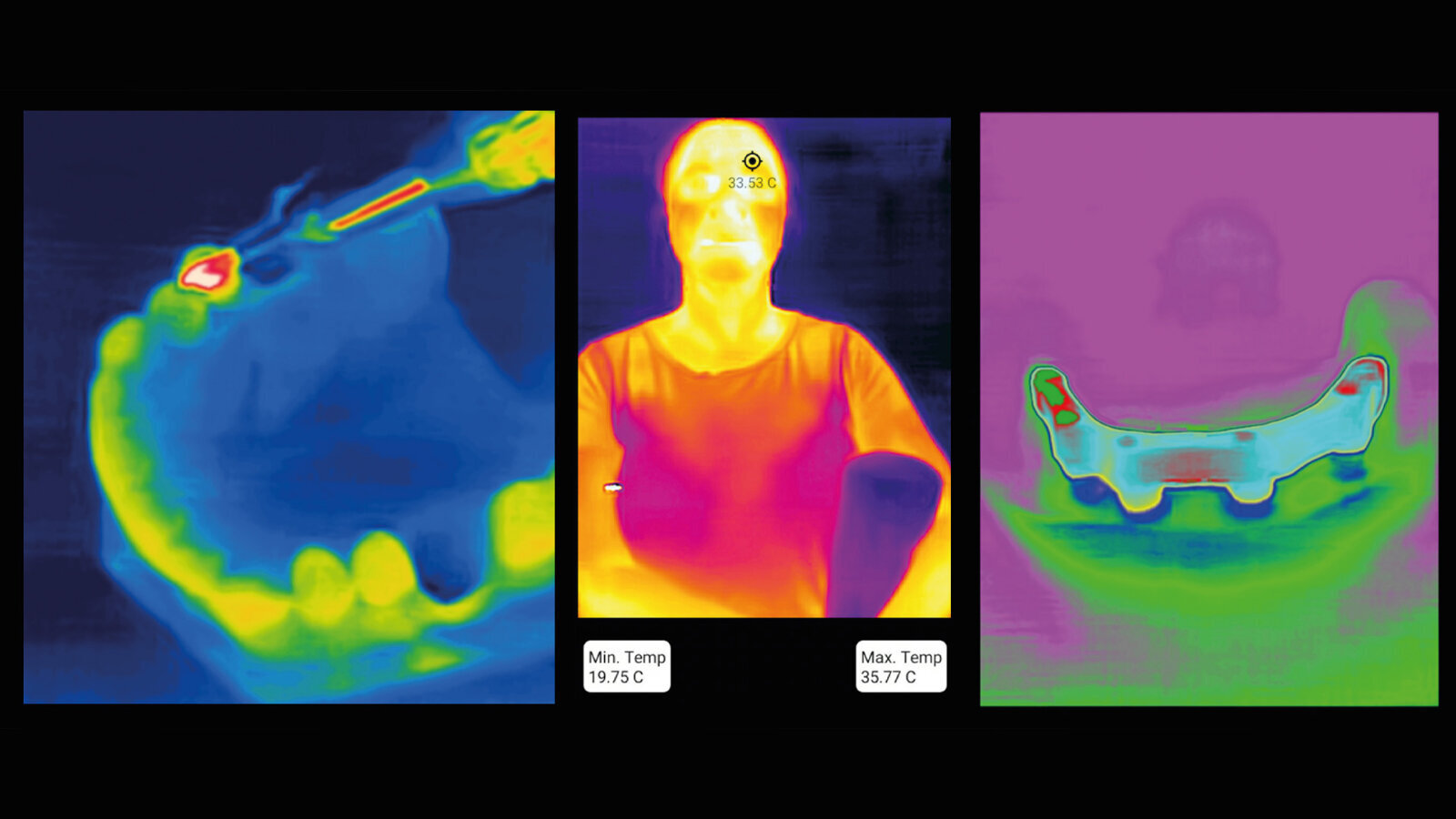 Dental Thermal App nudi „jednostavan, ali intuitivan, klinički zasnovan workflow“