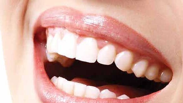 The dentist and the technician: A love story about breaking up with traditional methods