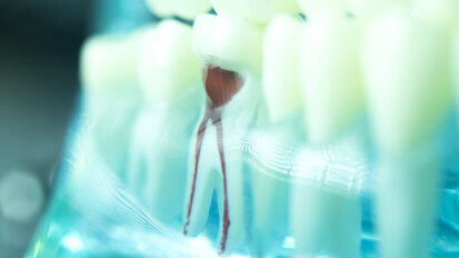 The access cavity in endodontics: Three rules for a predictable outcome in complex cases