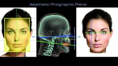 Aesthetic Digital Smile Design: Software-aided aesthetic dentistry—Part I