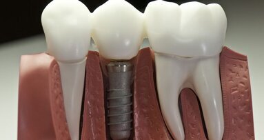 Onvrede over prijsafspraken implantaten VGZ