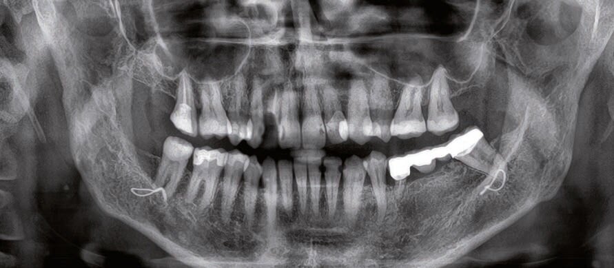 Fig. 1 - RX OPT.