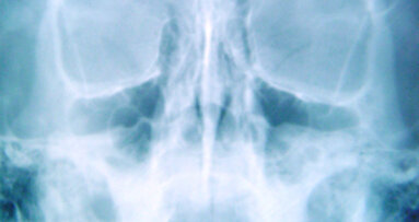 CBCT: maggiore sicurezza per la radiologia orale