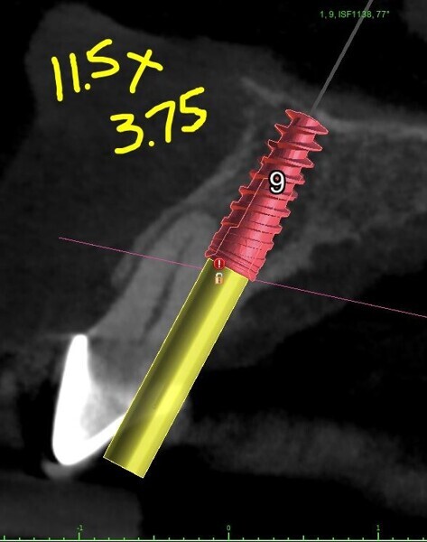 Fig. 4d