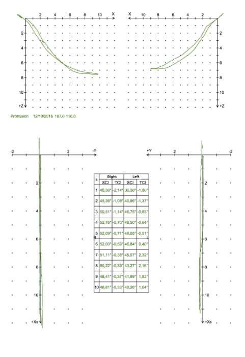 Fig. 16