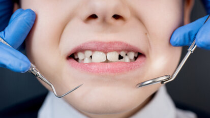 Improving oral health of people with intellectual disability
