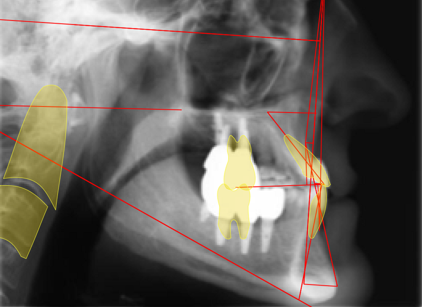 Fig. 31b